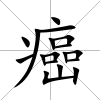 癌